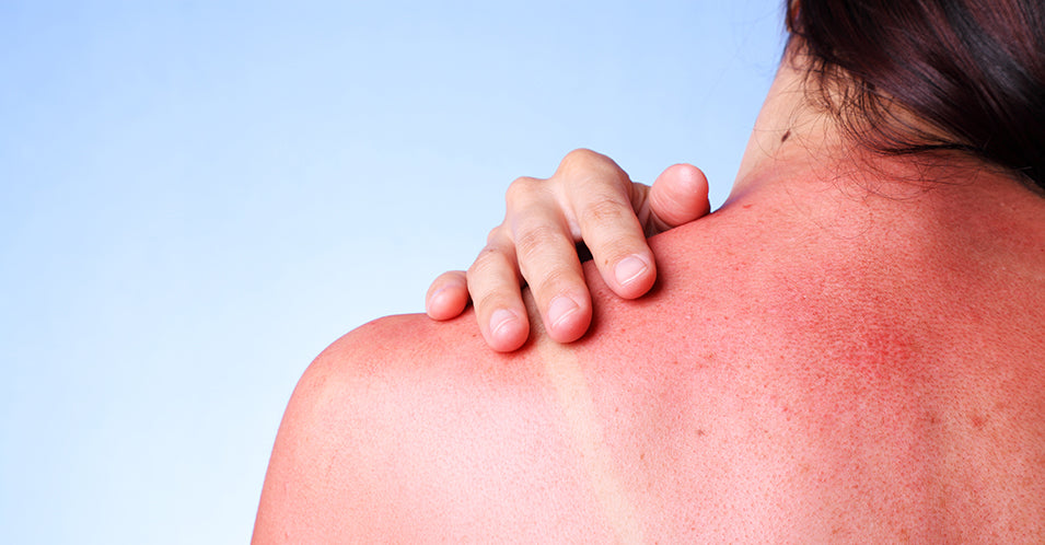 Crema doposole: a cosa serve, caratteristiche, come scegliere la migliore