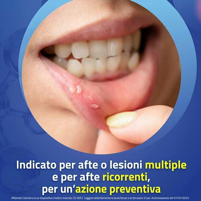 Aftamed Collutorio Anti Afte e Stomatiti 150 ml