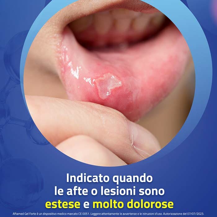 Aftamed Scudo Gel Anti-Afte 8 ml