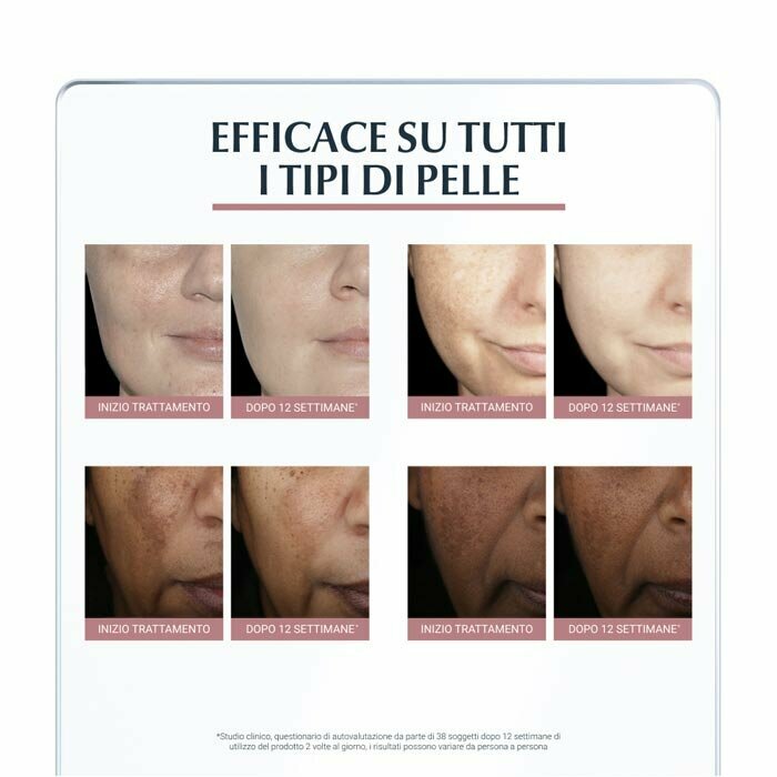 Eucerin Anti-Pigment Correttore Anti-Macchie Viso 15 ml