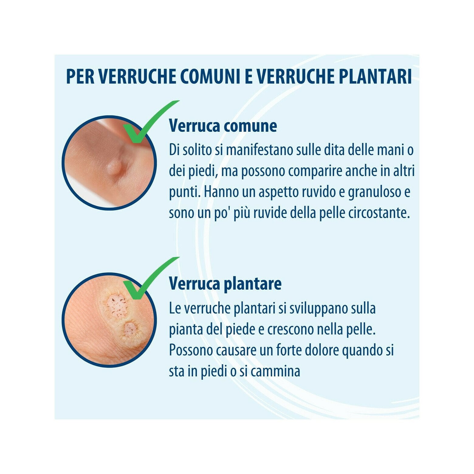 Evolsin penna antiverruca contro le verruche su piedi, mani, corpo, braccia & gambe 3ml