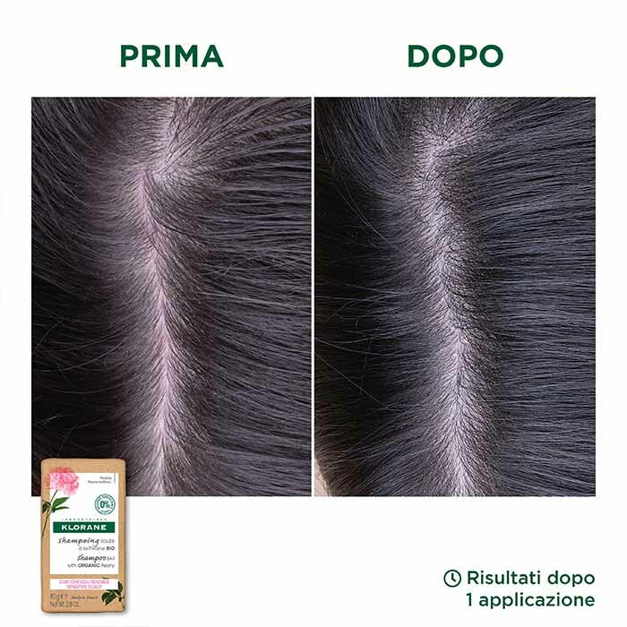 Klorane Shampoo Solido Lenitivo Peonia Bio 80 g