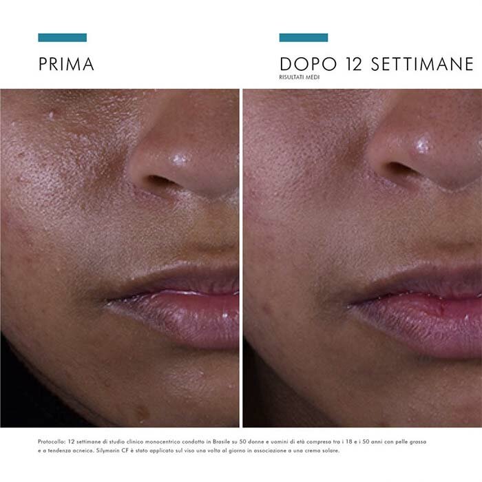 Skinceuticals Silymarin CF Siero Antiossidante con Vit. C 30 ml