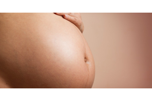 Le vene varicose in gravidanza: cause, sintomi e trattamenti