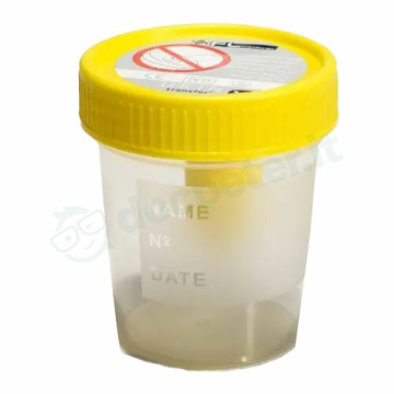 Contenitore per urina tappo a vite prelievo sottovuoto da 120ml 