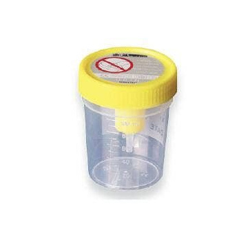 Contenitore urina sterile medipresteril con sistema transfert per provette sottovuoto